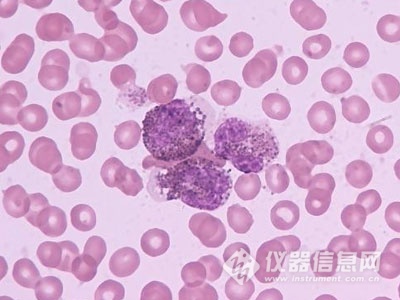 132336634198.jpg 20161117131745_92943.jpg